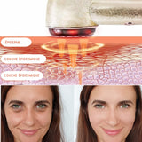 Appareil Anti-Rides Visage 7-en-1 — EMS RF LED — Lifting Raffermissant — Soin Professionnel Maison